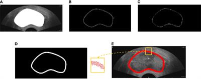 Structure boundary-preserving U-Net for prostate ultrasound image segmentation